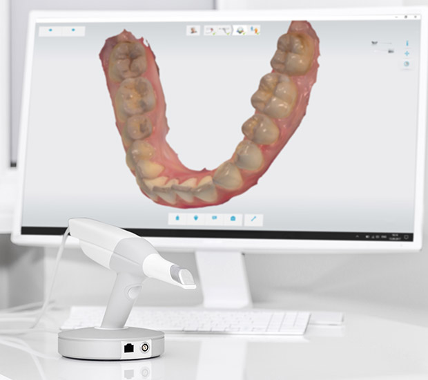Ijamsville 3D Cone Beam and 3D Dental Scans