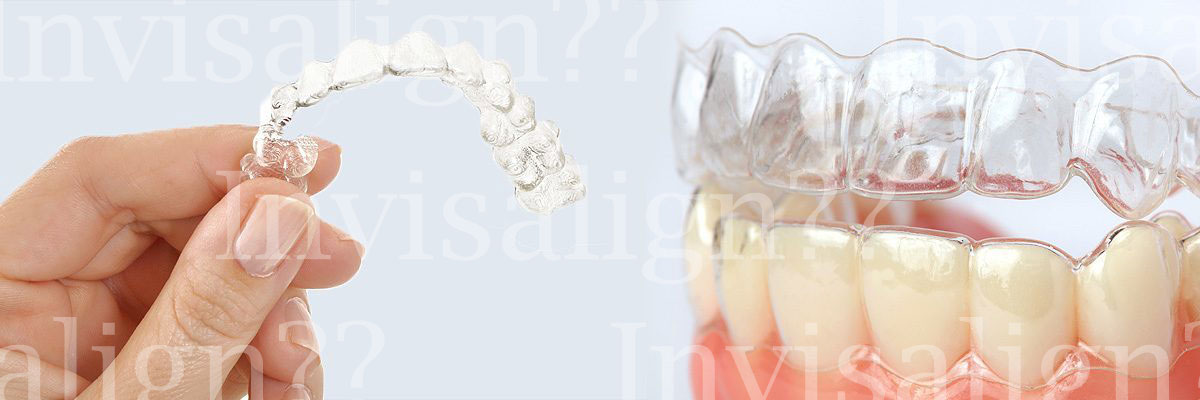 Ijamsville Does Invisalign® Really Work?
