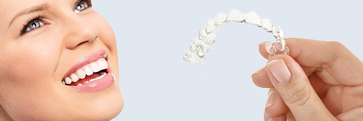 Ijamsville 7 Things Parents Need to Know About Invisalign Teen