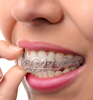 Clear Aligners - Almost Invisible Braces Ijamsville, MD