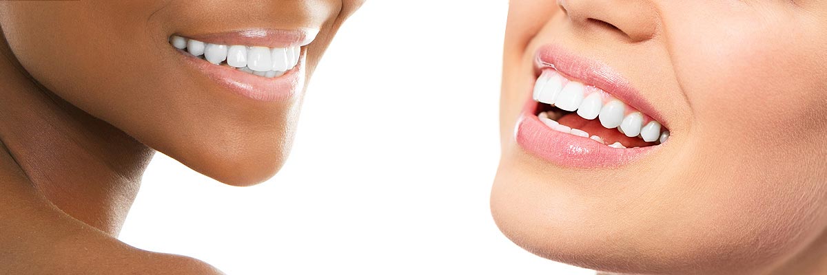 Ijamsville Teeth Whitening