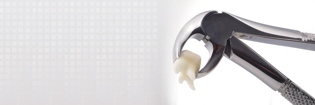 Ijamsville Tooth Extraction